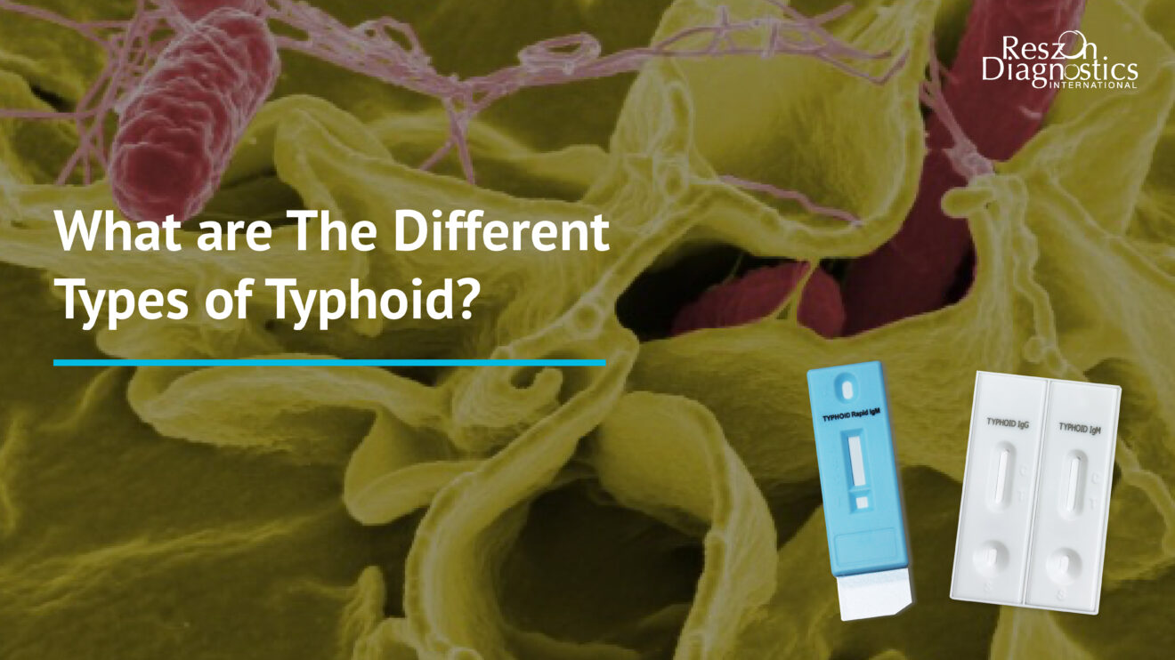 What are The Different Types of Typhoid? Reszonics