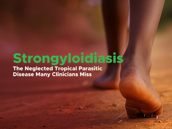Strongyloidiasis