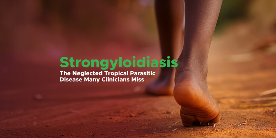 Strongyloidiasis