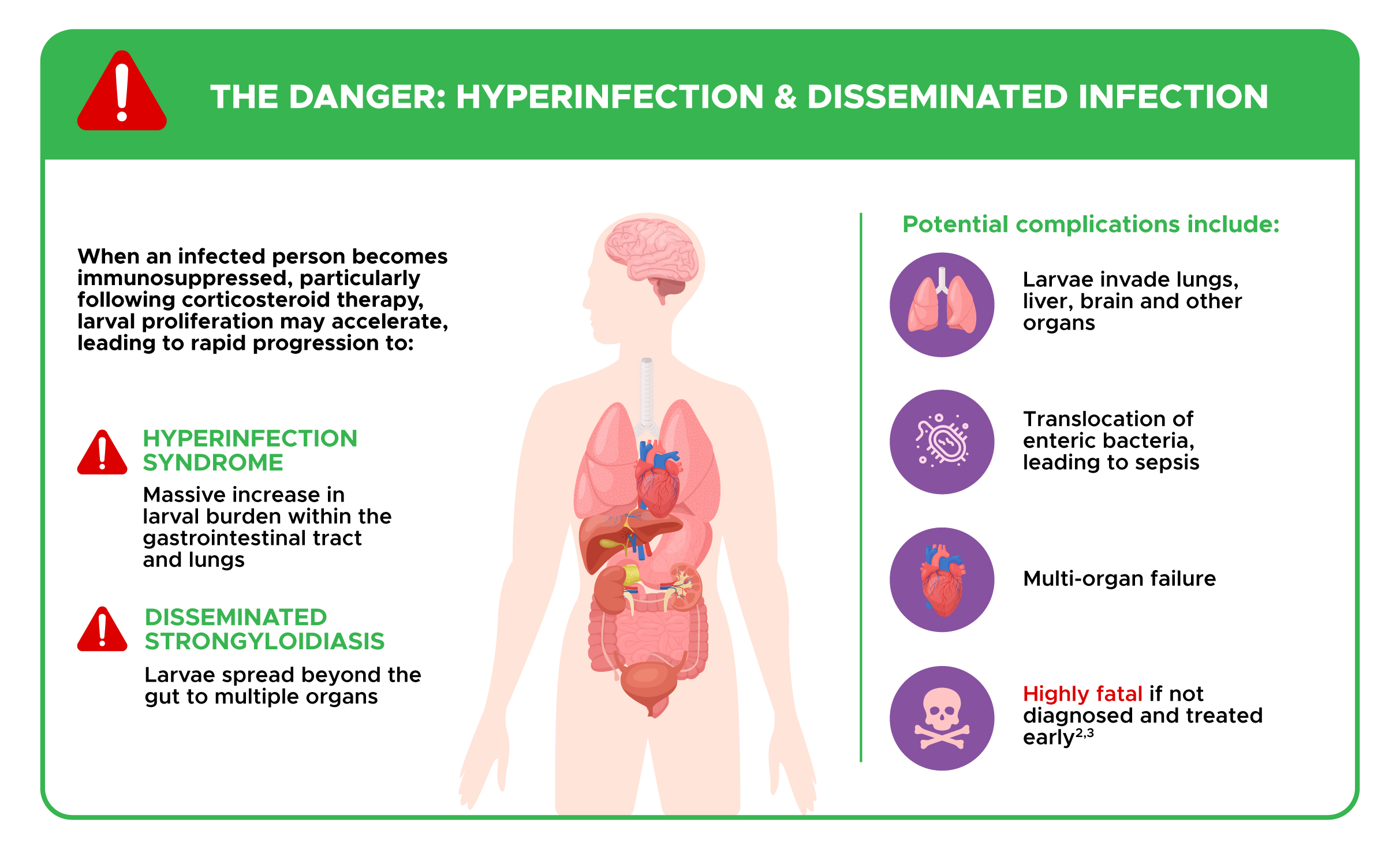 HYPERINFECTION & DISSEMINATED STRONGYLOIDIASIS INFECTION